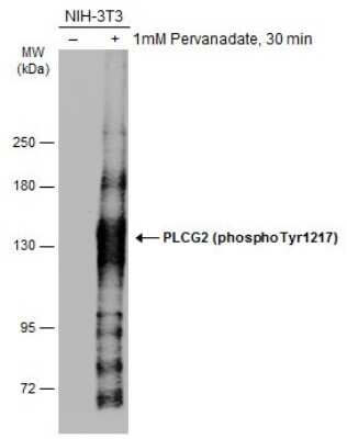 Western Blot: PLC-gamma 2 [p Tyr1217] Antibody [NBP3-13270] - Untreated (-) and treated (+) NIH-3T3 whole cell extracts (10 ug) were separated by 5% SDS-PAGE, and the membrane was blotted with PLC-gamma 2 (phospho Tyr1217) antibody (NBP3-13270) diluted at 1:1000. The HRP-conjugated anti-rabbit IgG antibody (NBP2-19301) was used to detect the primary antibody.